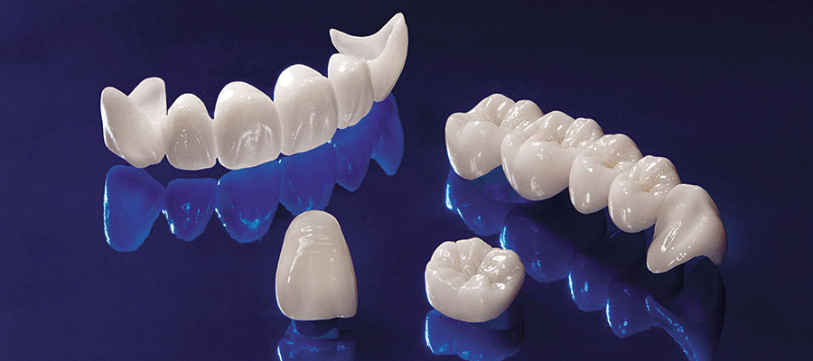 Estetik Diş Tedavileri