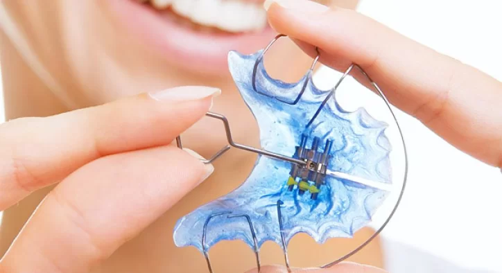 Tel tedavisi/Ortodonti